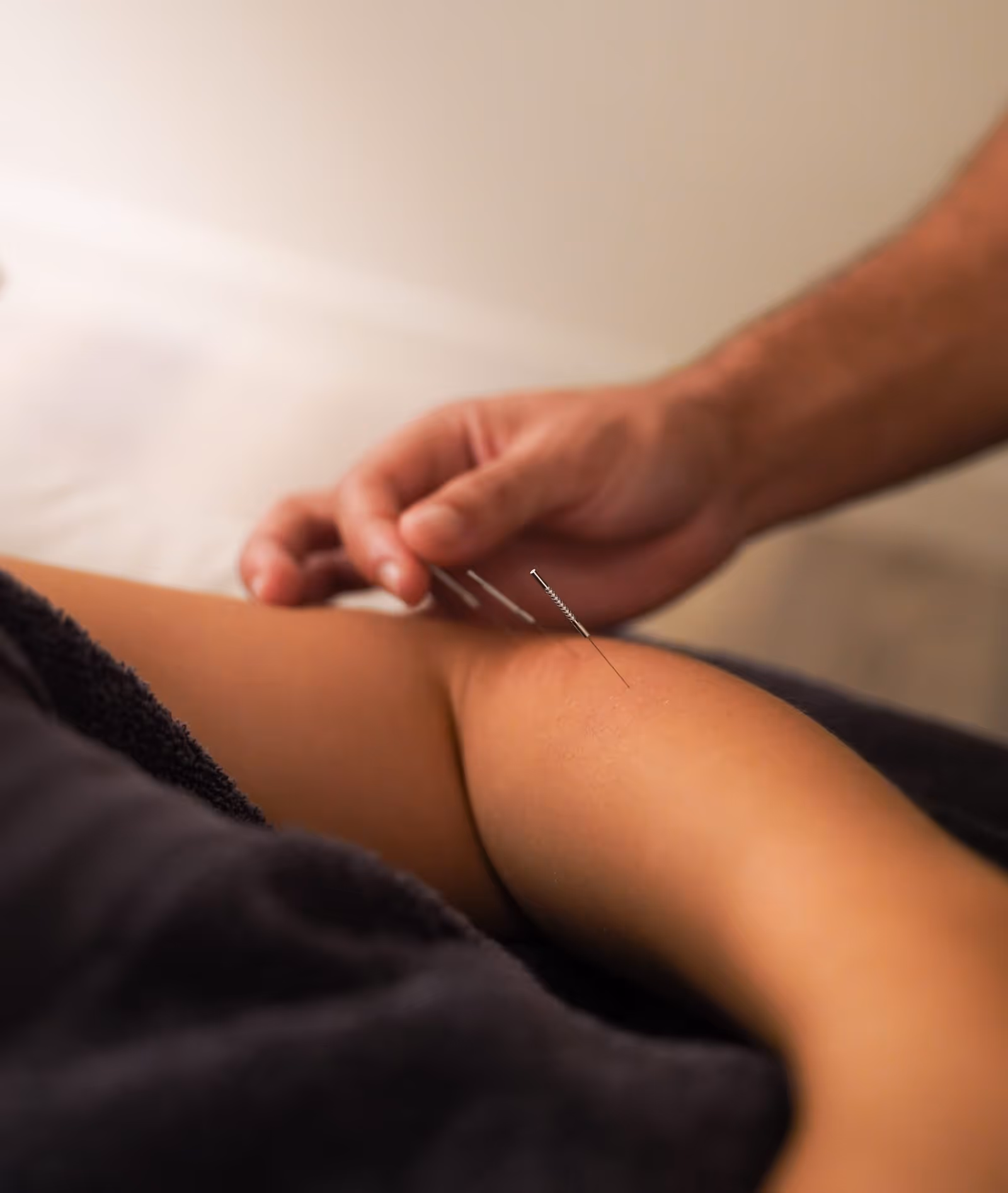 Dry needling treatment at Baseline Osteopathy - a fine needle applied to a patient's hamstring