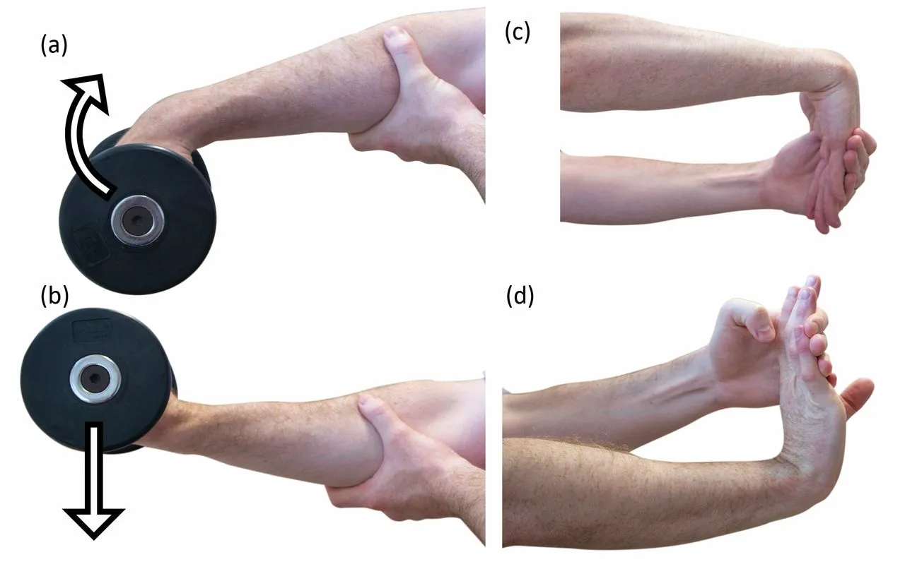 Stages and presentation of lateral elbow tendinopathy